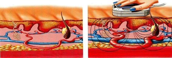 ja jūsu kājas kļūst nejūtīgas